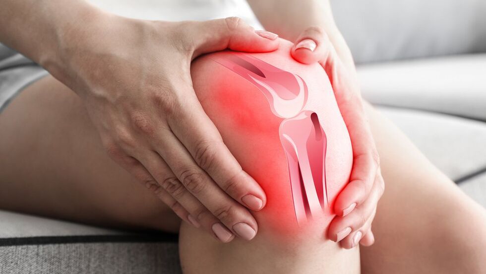 Leczenie bólu stawów Osteflex